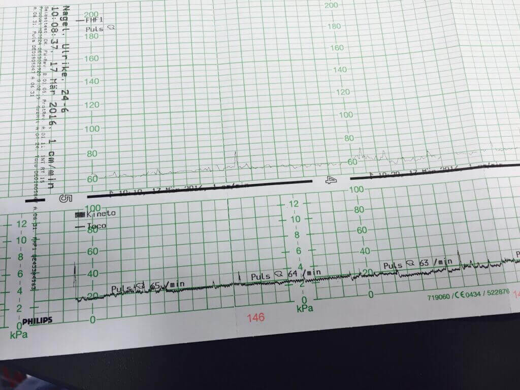 Kaart met grafieken bij de zwangerschap
